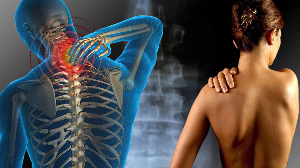 Fibromialgia: Entendendo a Dor Invisível que Afeta Corpo e Mente